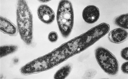 严重细菌性肺部感染！纽约爆发军团菌：67人患病 3人死亡 !